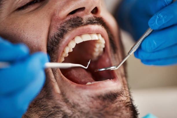 Best Emergency Dentist for Knocked-Out Tooth in Vista, CA