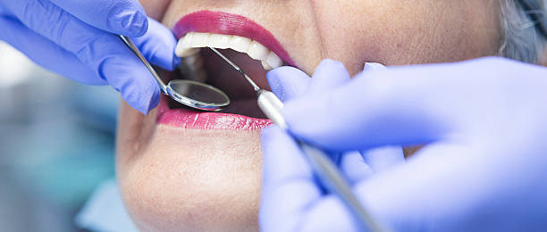 Best Emergency Dentist for Knocked-Out Tooth in Vista, CA